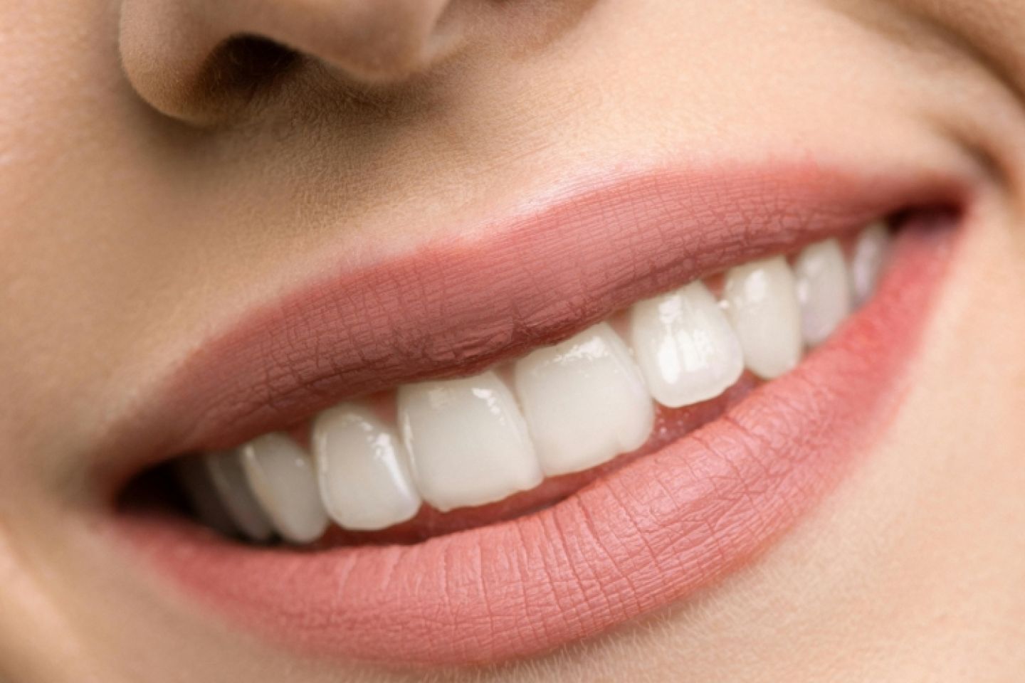 Salisbury Teeth Whitening Top Ups