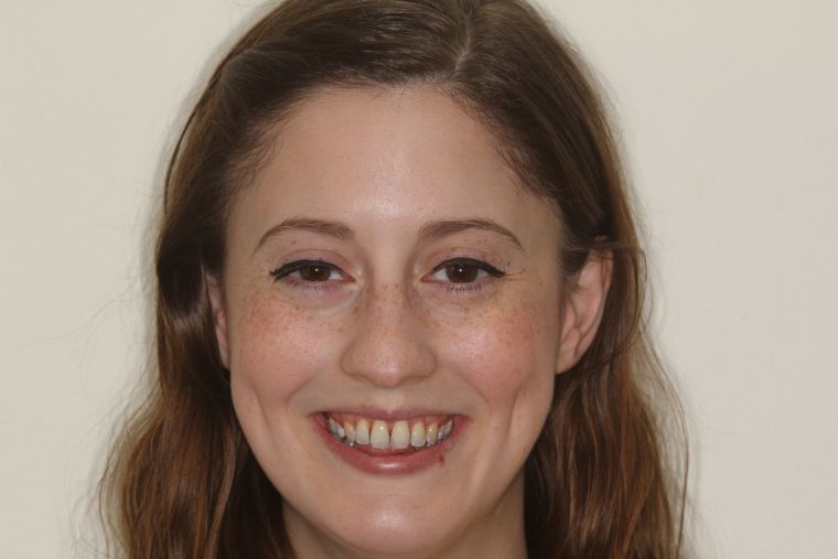 Portrait picture of laura smith following her hygiene, invisalign and teeth whitening treatment.